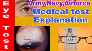 Defence Medical and Physical Test Explanation